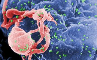 Science, Progress & HIV