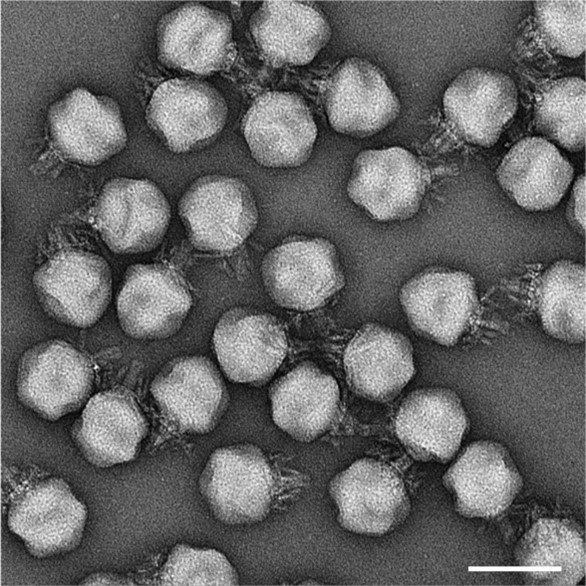 A micrograph of multiple crassviruses. Owing to the virus’ size, the team had to capture zoomed-out images to collect enough particles for their analysis. Scale bar = 100 nm. Image credit: Oliver Bayfield